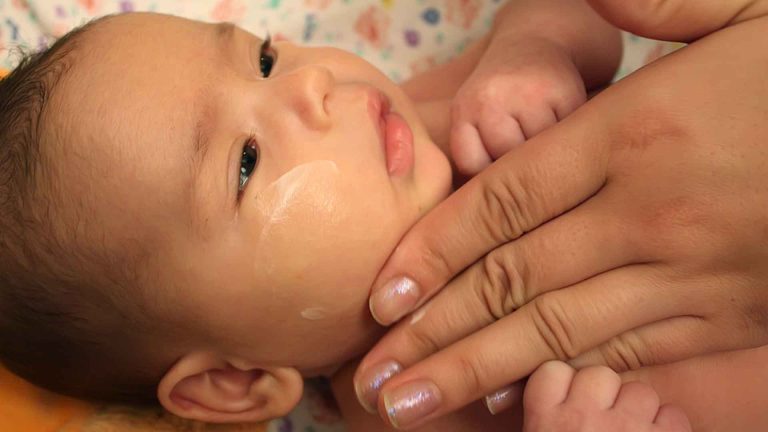 7 Langkah Praktis Mengatasi Masalah Kulit pada Anak