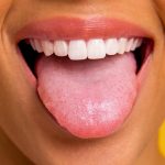 10 Tanda Lidah Tidak Sehat yang Harus Kamu Waspadai