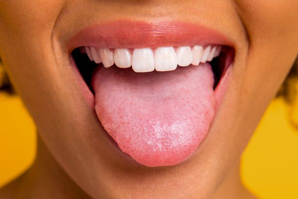 10 Tanda Lidah Tidak Sehat yang Harus Kamu Waspadai 10 Tanda Lidah Tidak Sehat yang Harus Kamu Waspadai