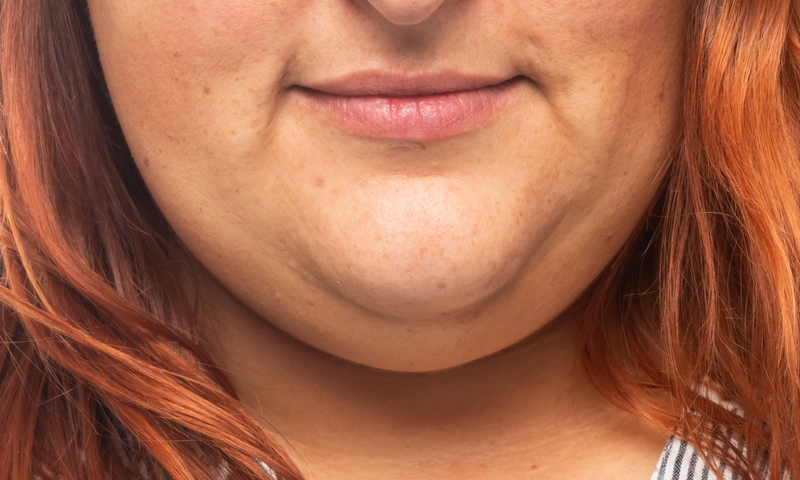 10 Cara Menghilangkan Double Chin secara Alami