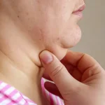10 Tips Menghindari Dagu Ganda Secara Alami
