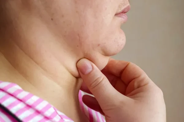 10 Tips Menghindari Dagu Ganda Secara Alami 10 Tips Menghindari Dagu Ganda Secara Alami