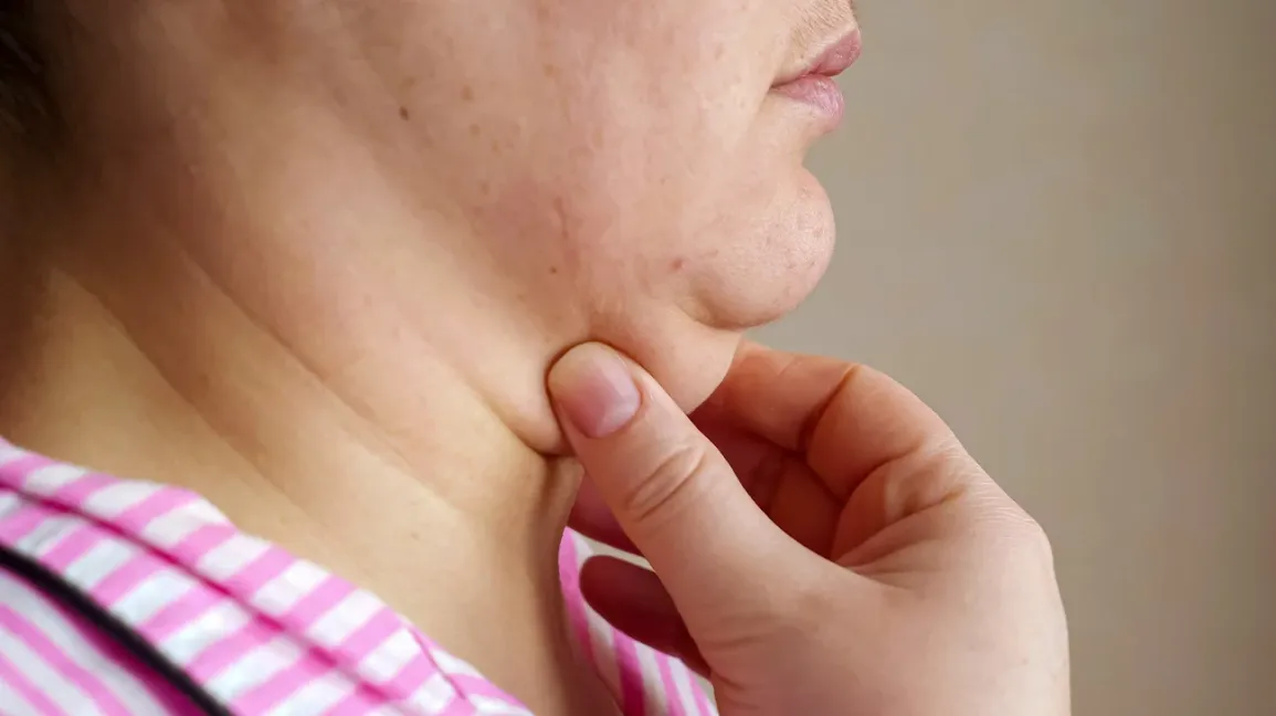 10 Tips Menghindari Dagu Ganda Secara Alami
