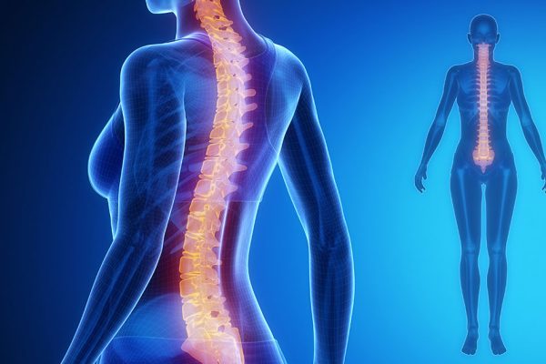 5 Tips Sederhana untuk Mencegah Masalah pada Tulang Belakang